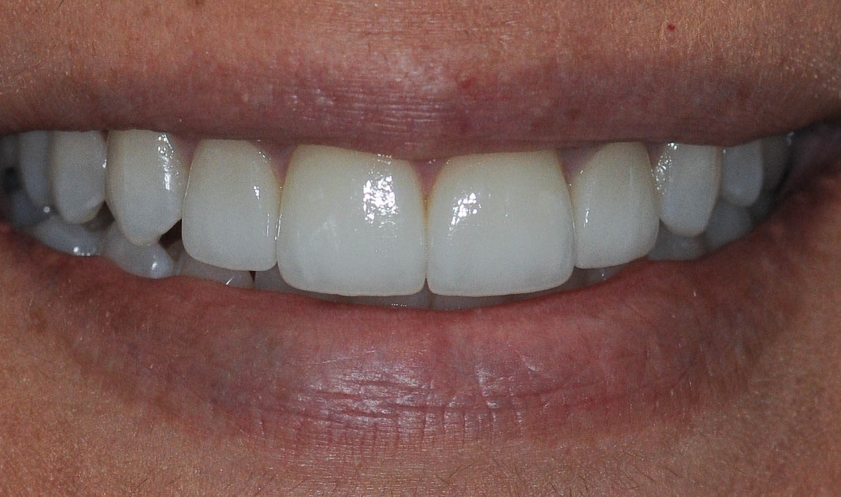 After Image