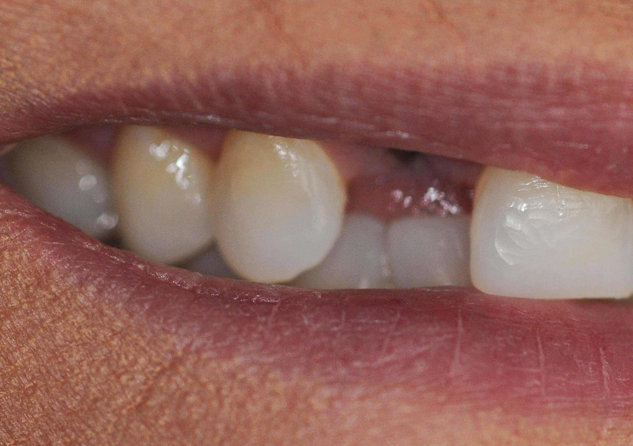 Before Image