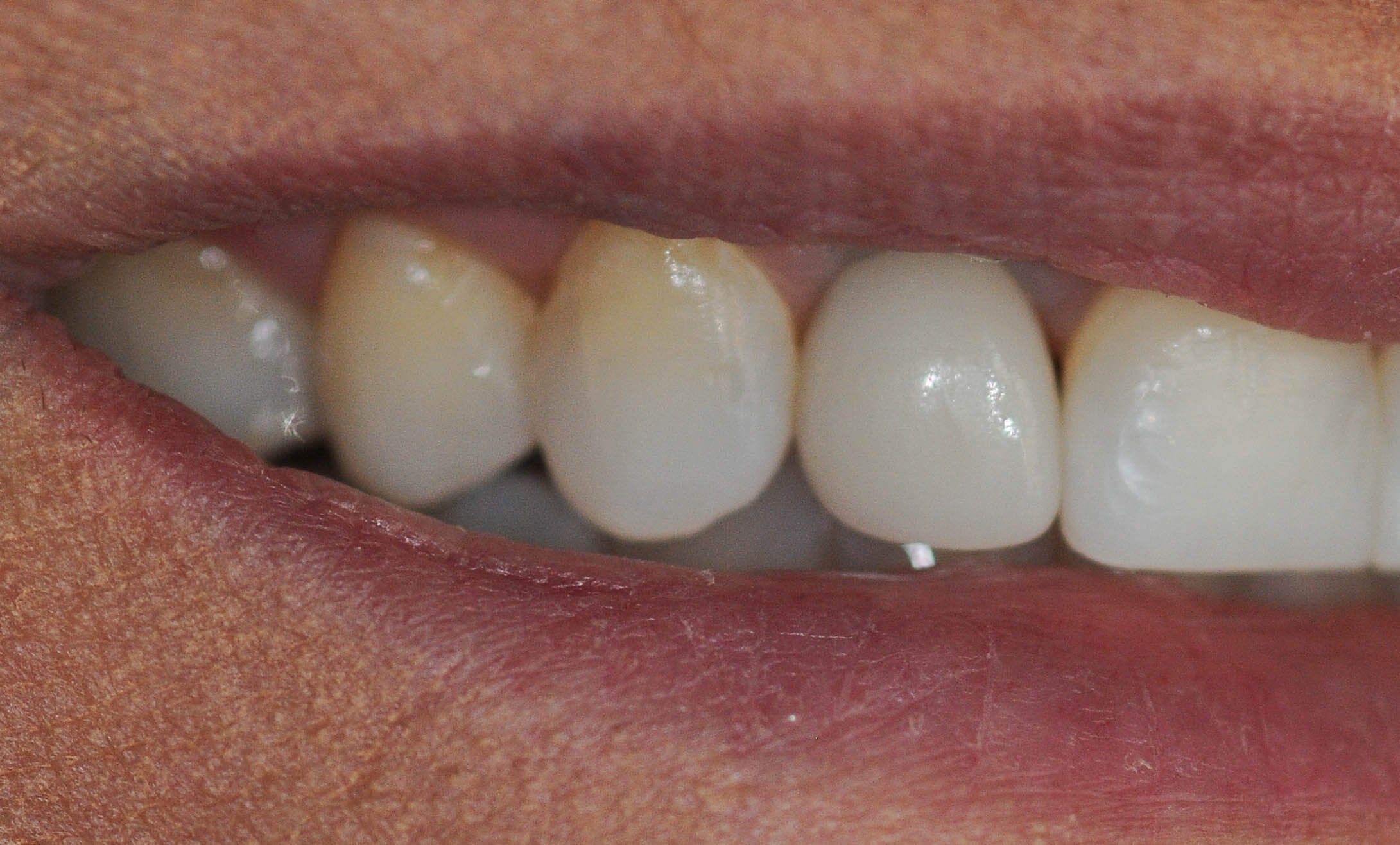 After Image