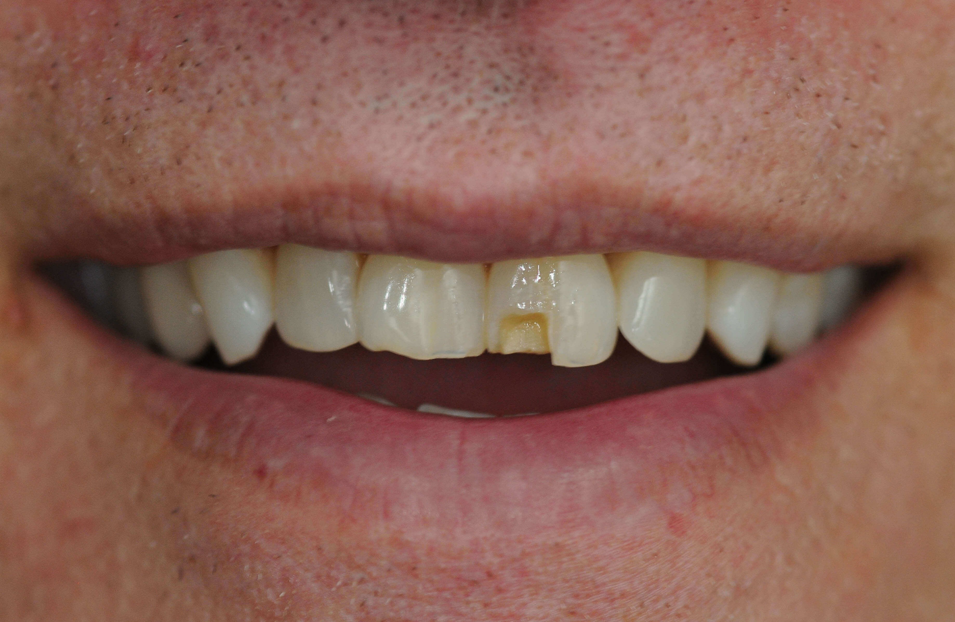 Before Image