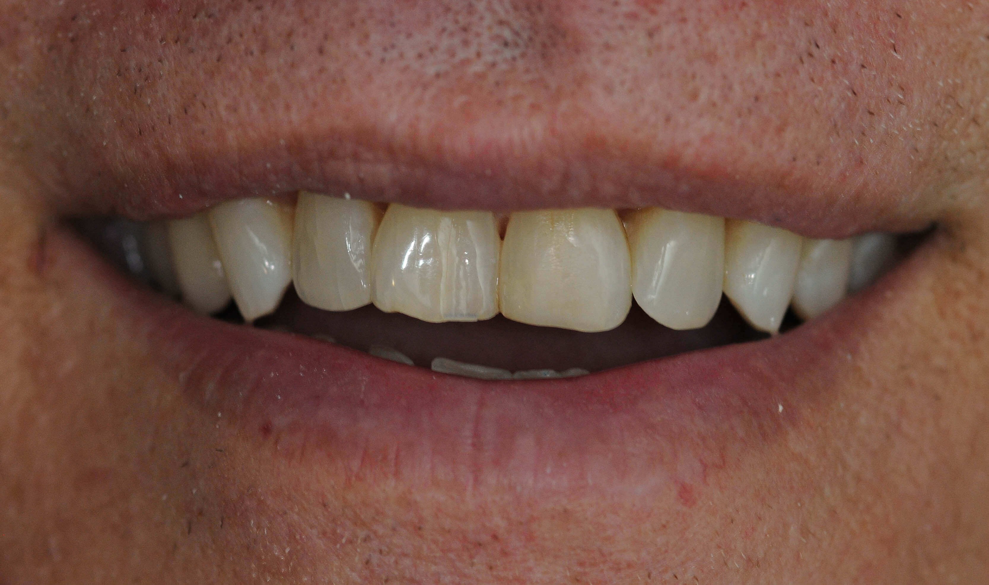 After Image