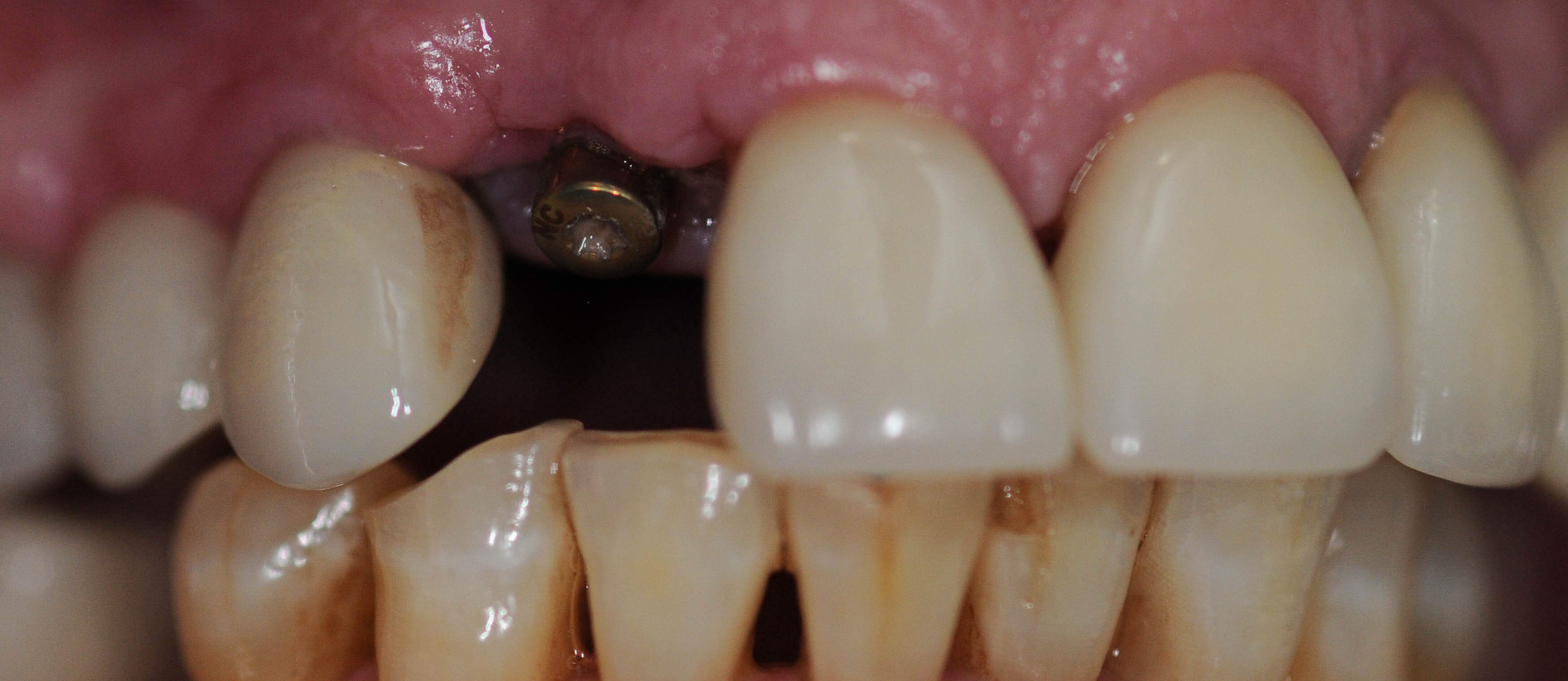 Before Image