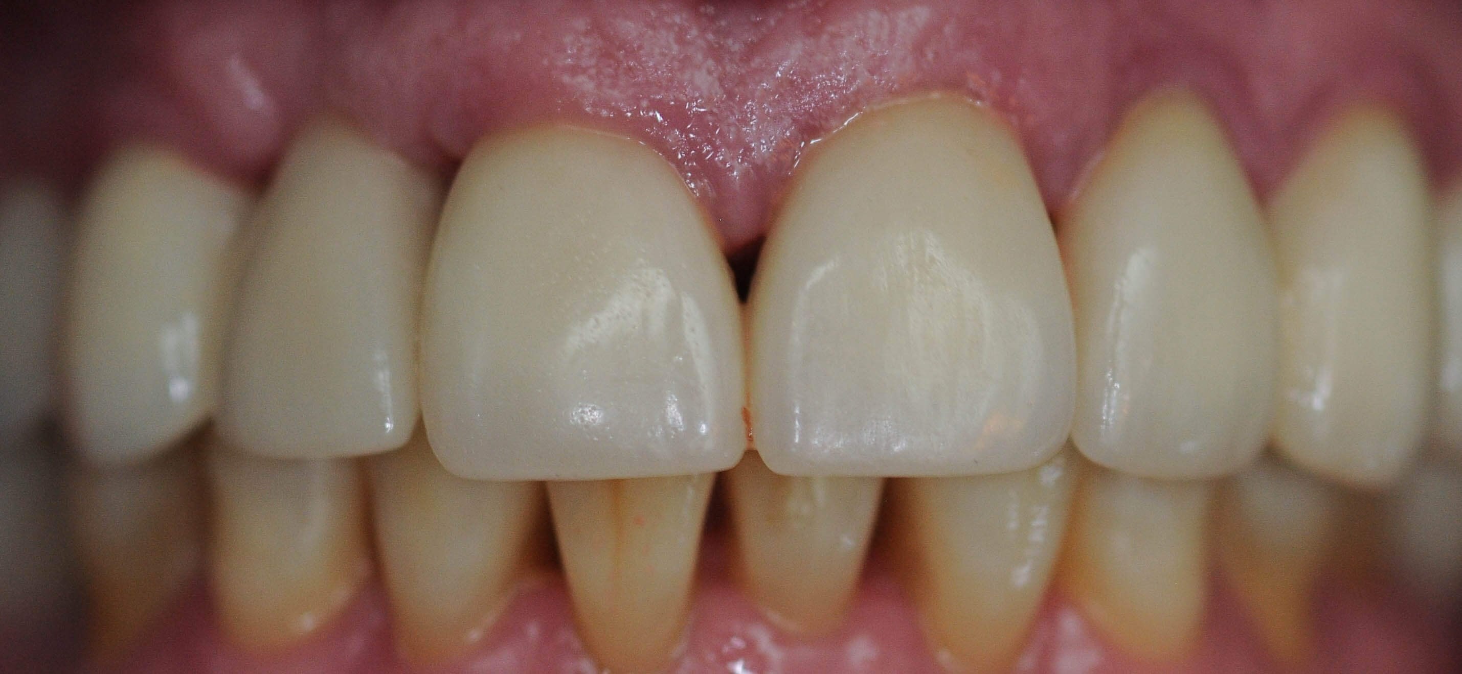 After Image