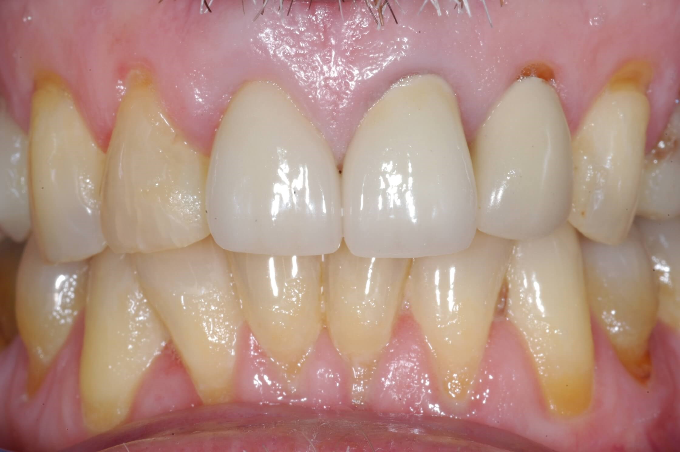 Before Image