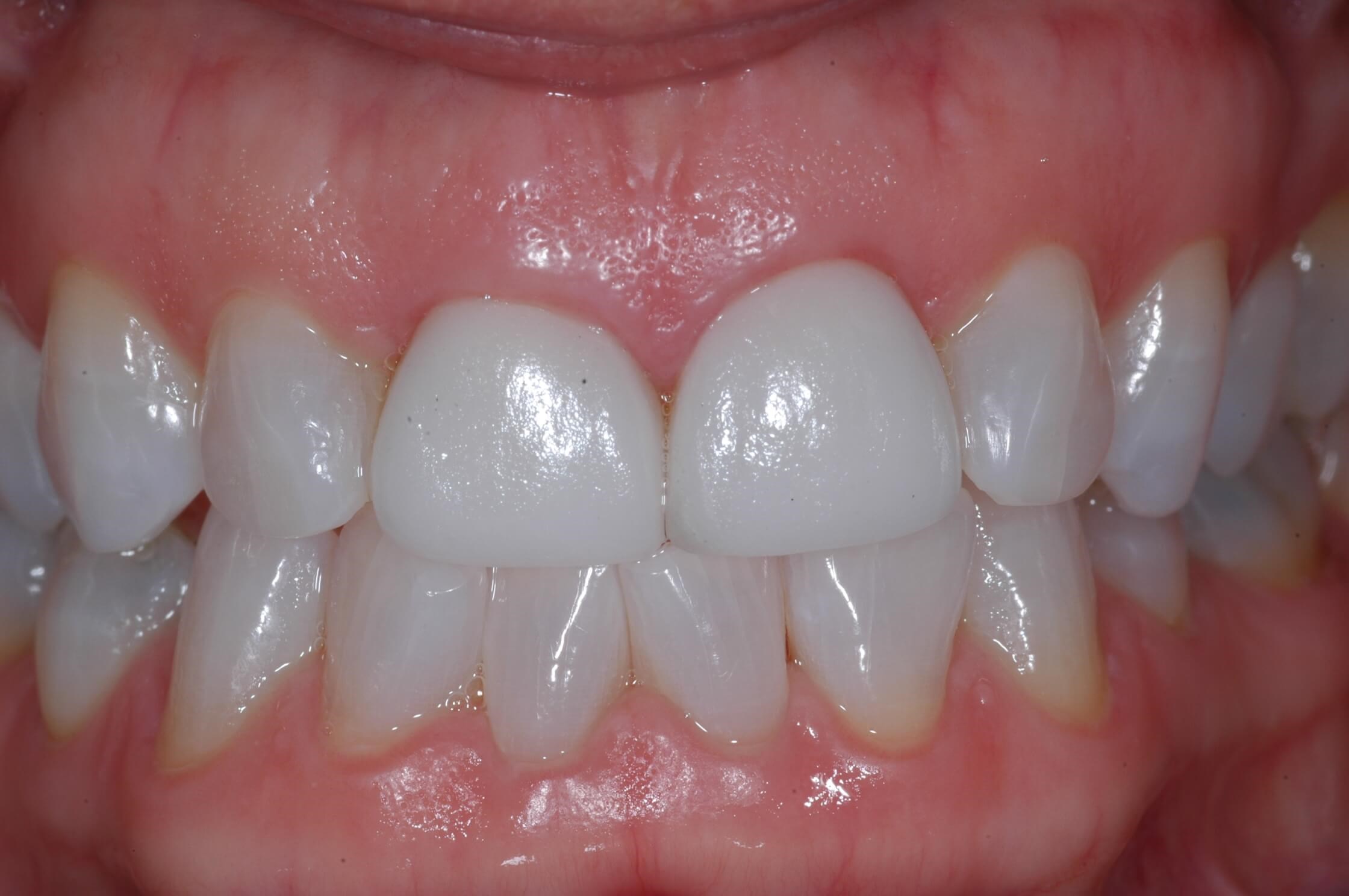 Before Image