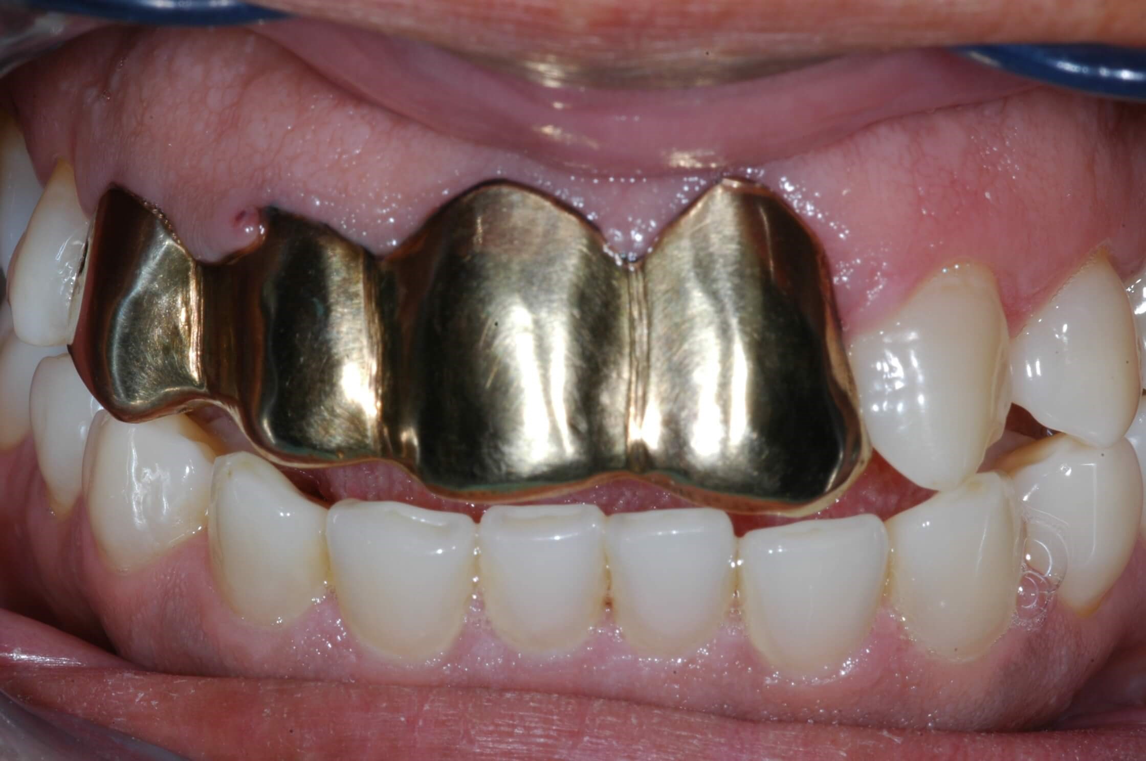 Before Image