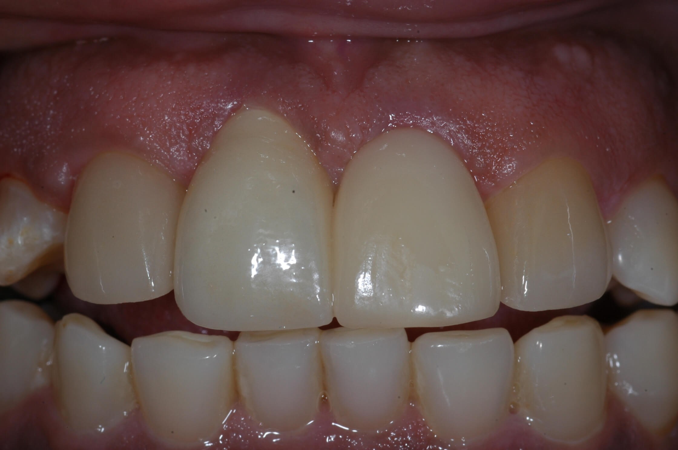 After Image