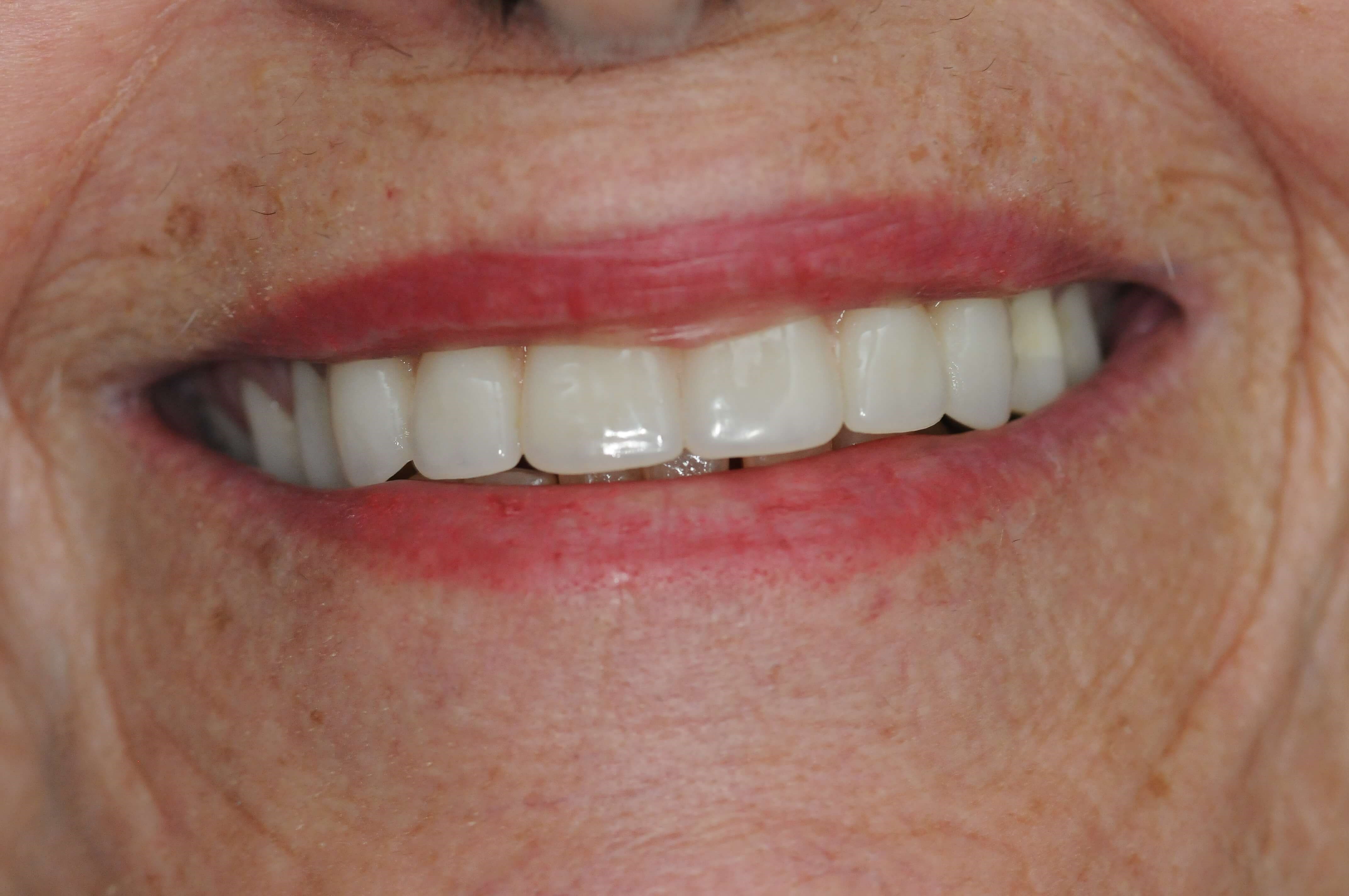 Close-up smiling After