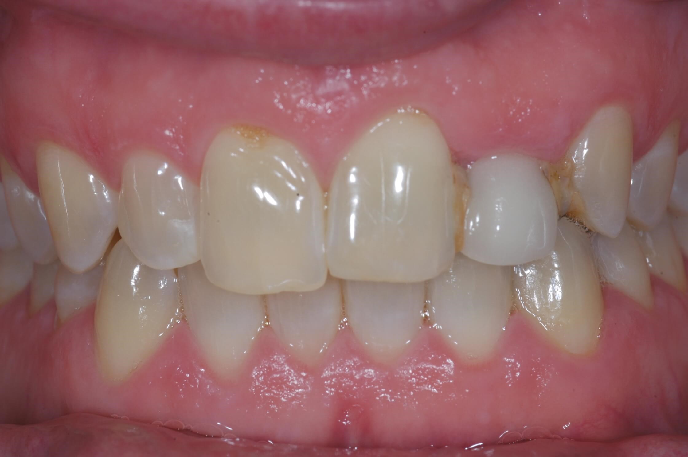 Before Image