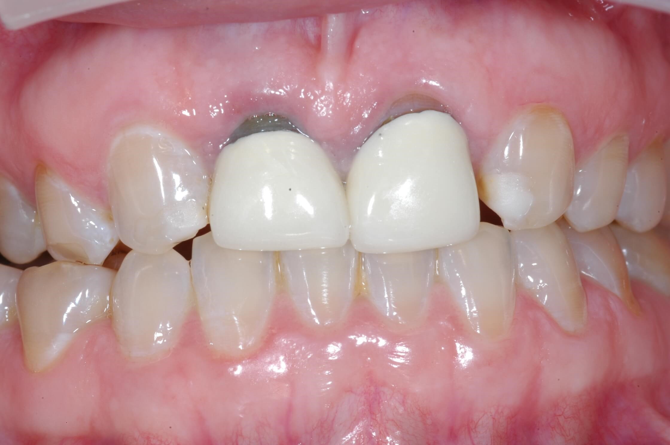Before Image