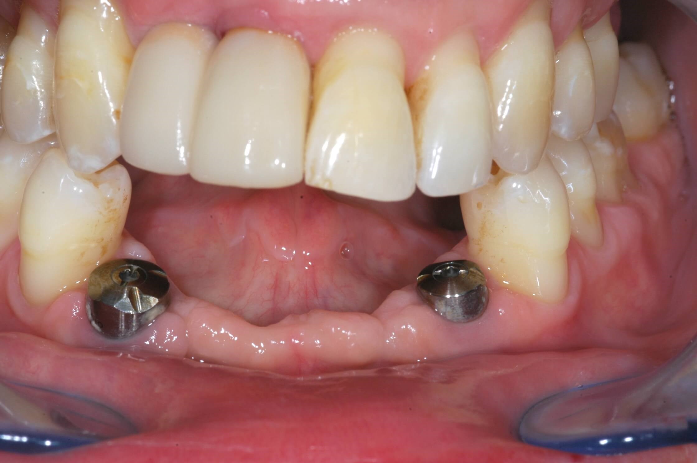 Before Image