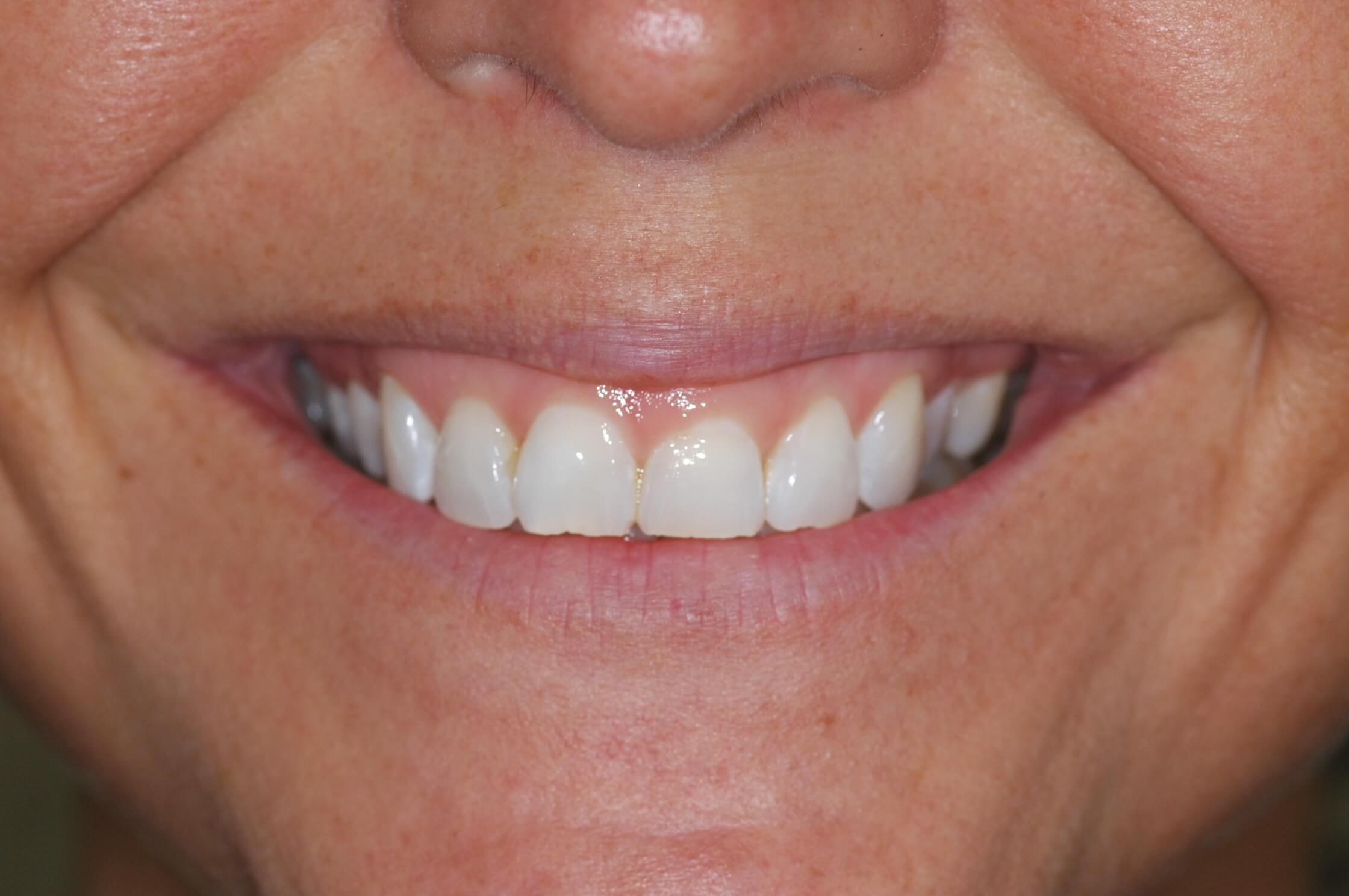 Her Smile Before