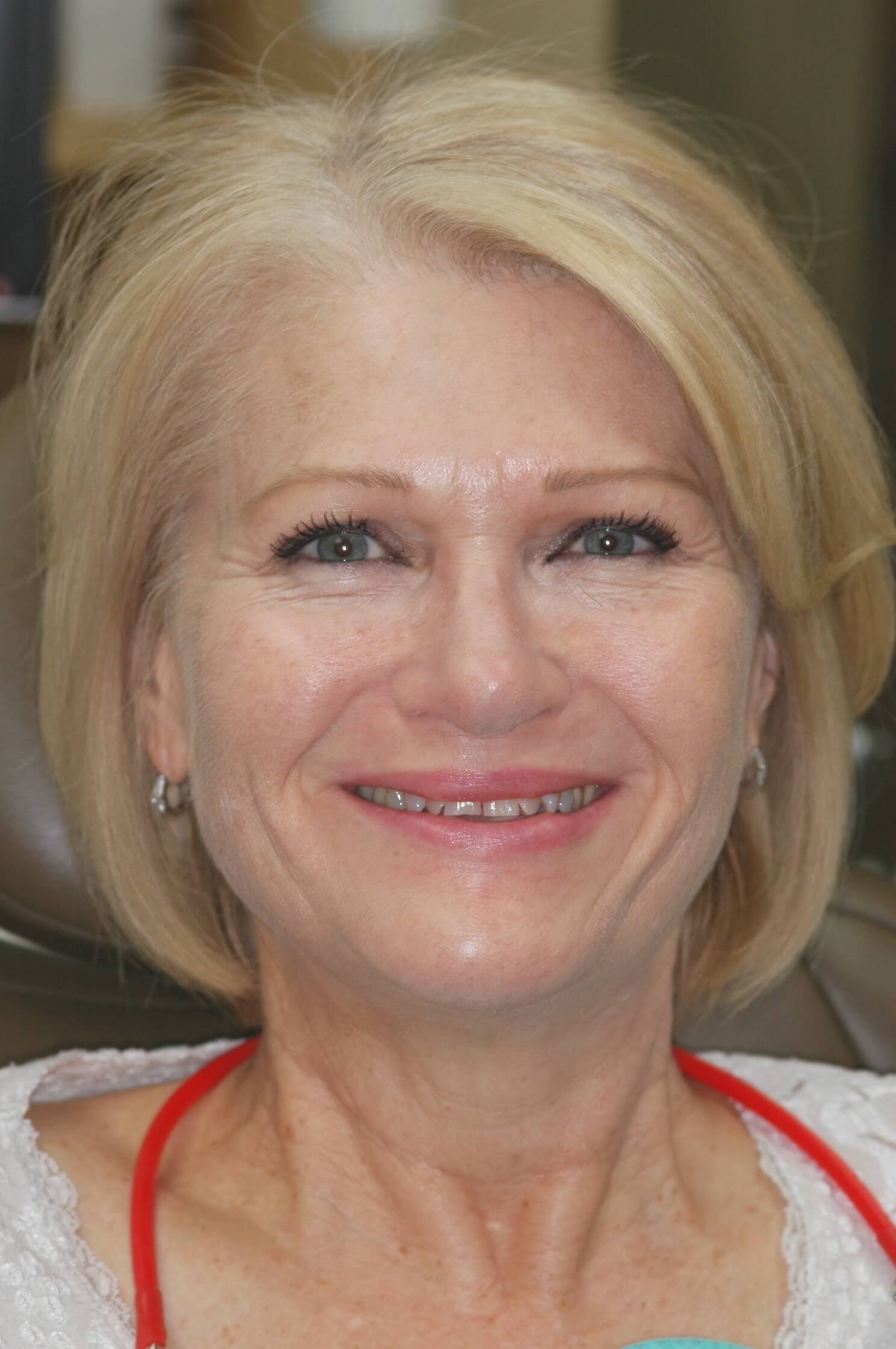 Gorgeous Smile Before