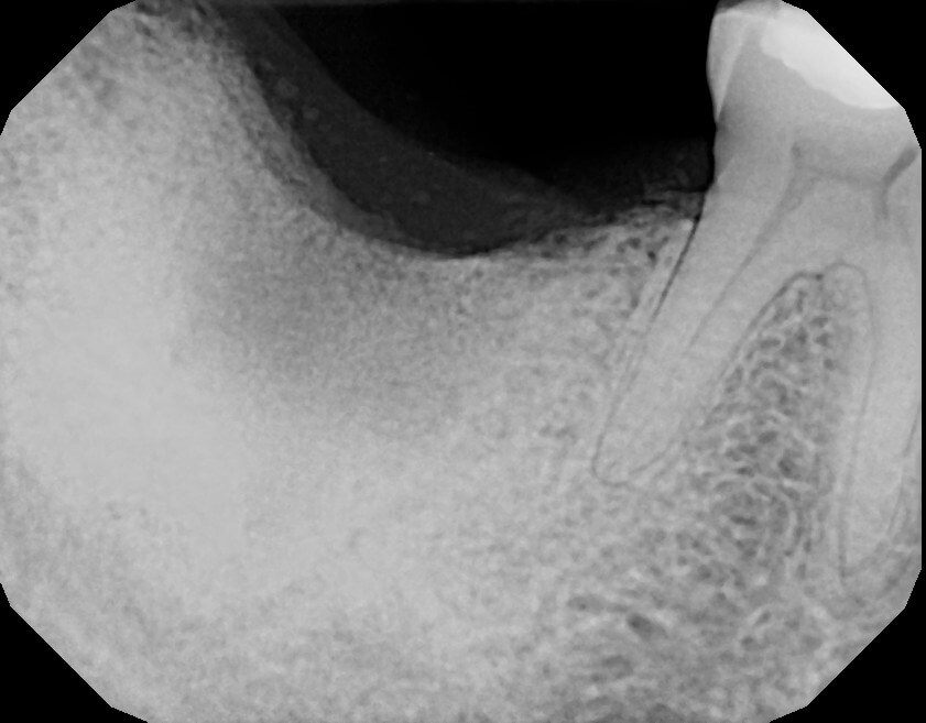 After Image
