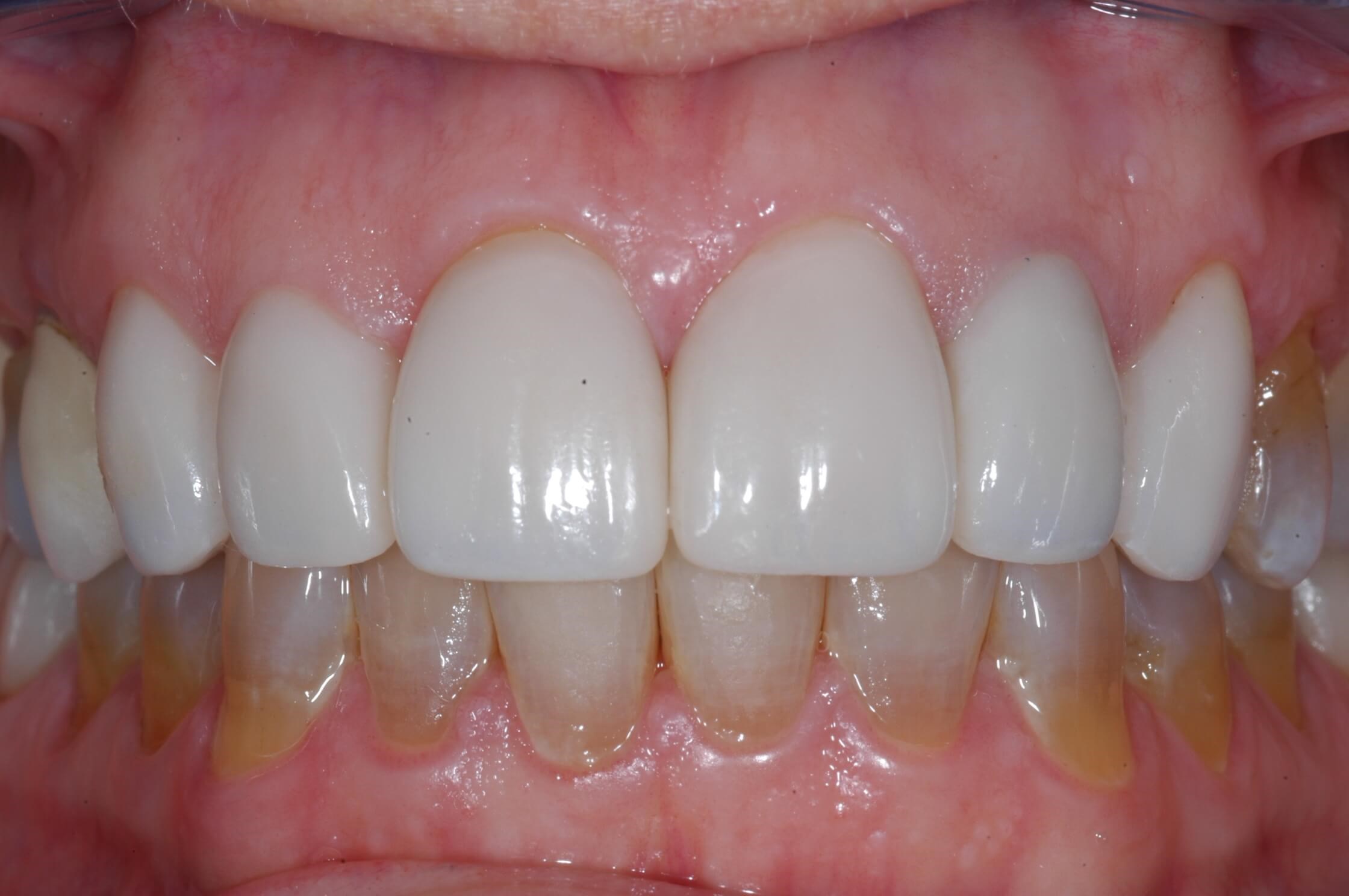 After Image