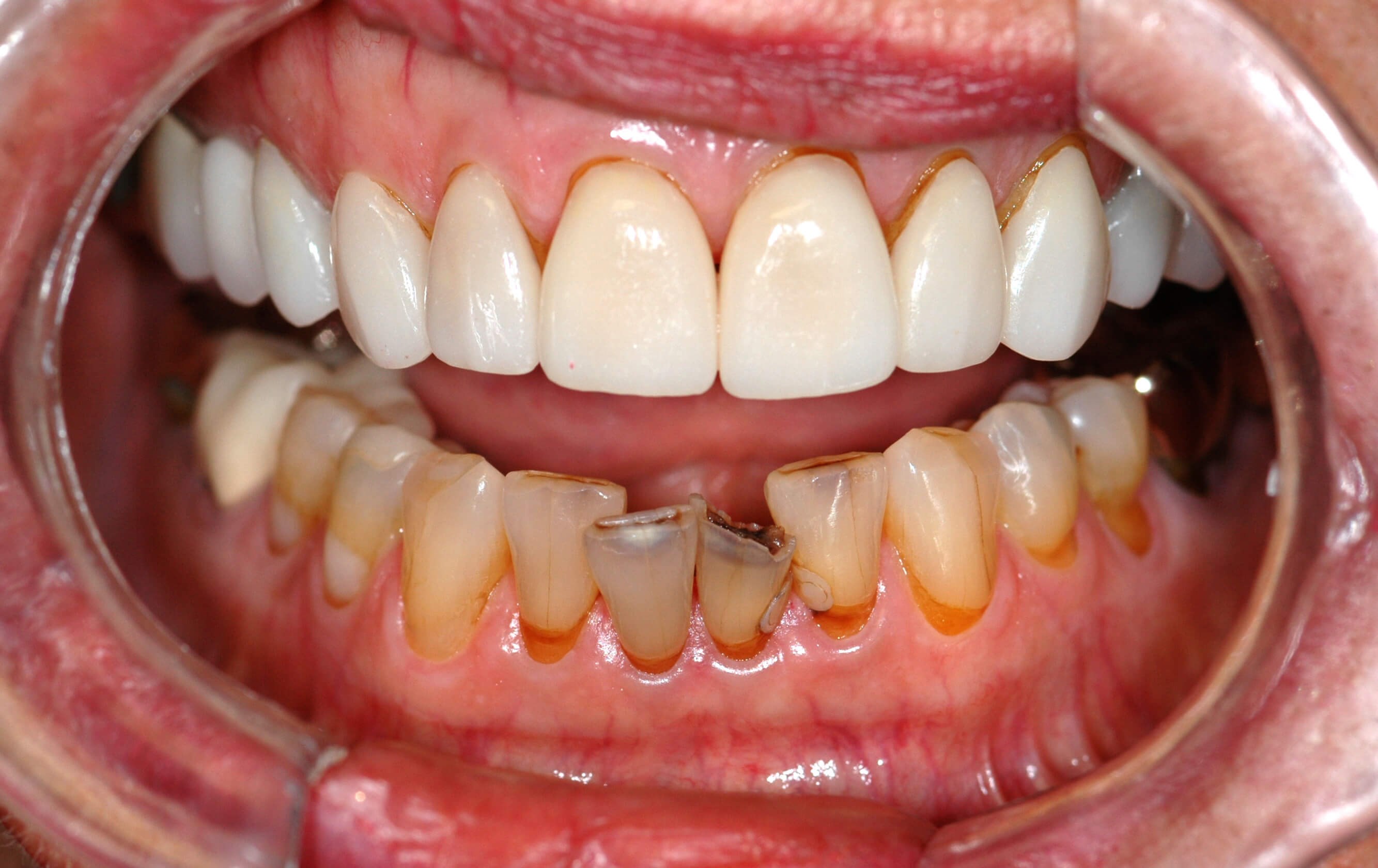 Before Image