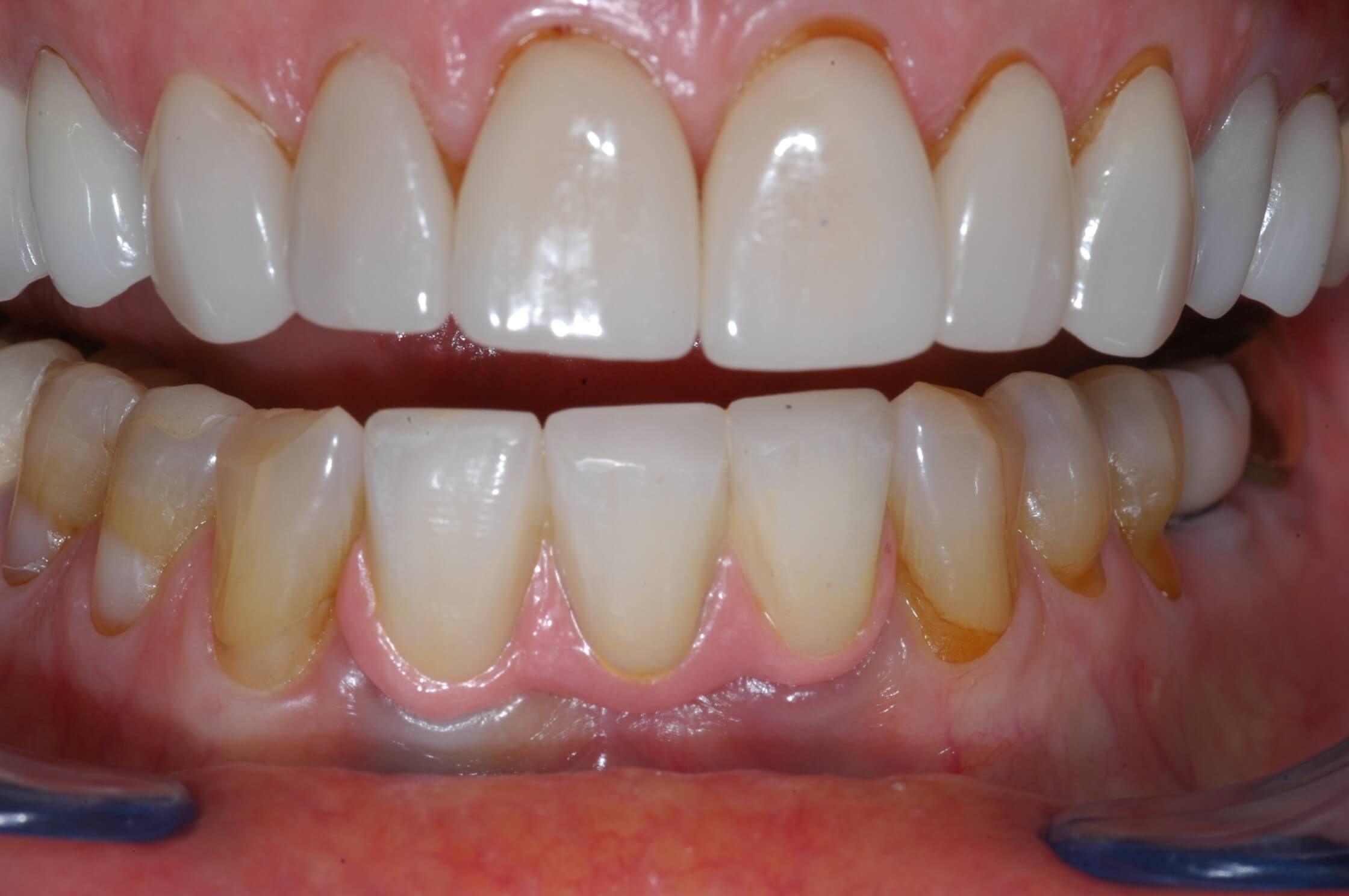 After Image