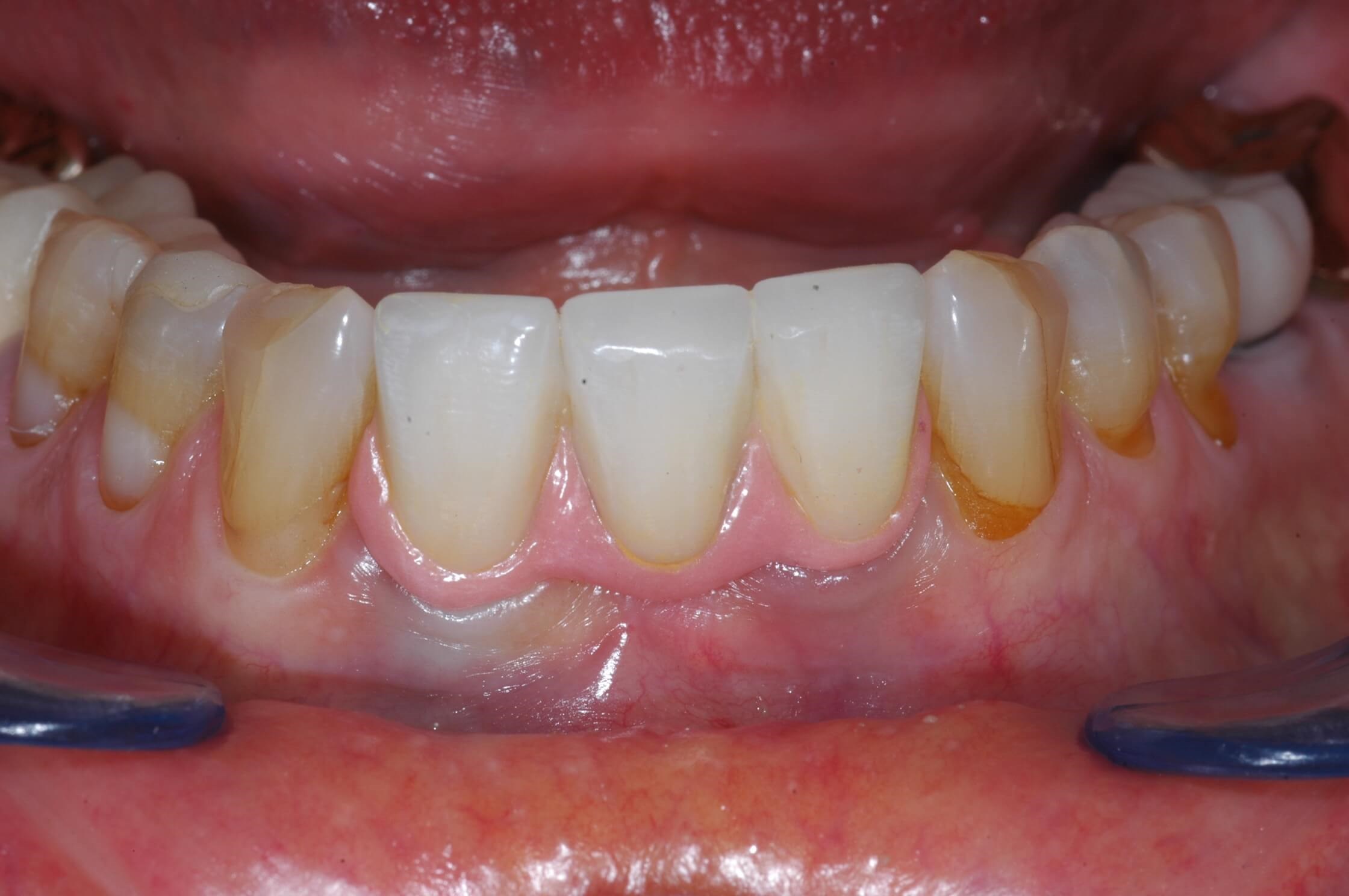 More pictures After