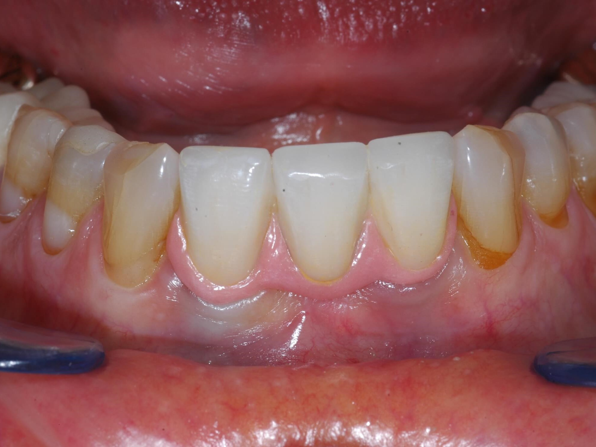 More pictures After