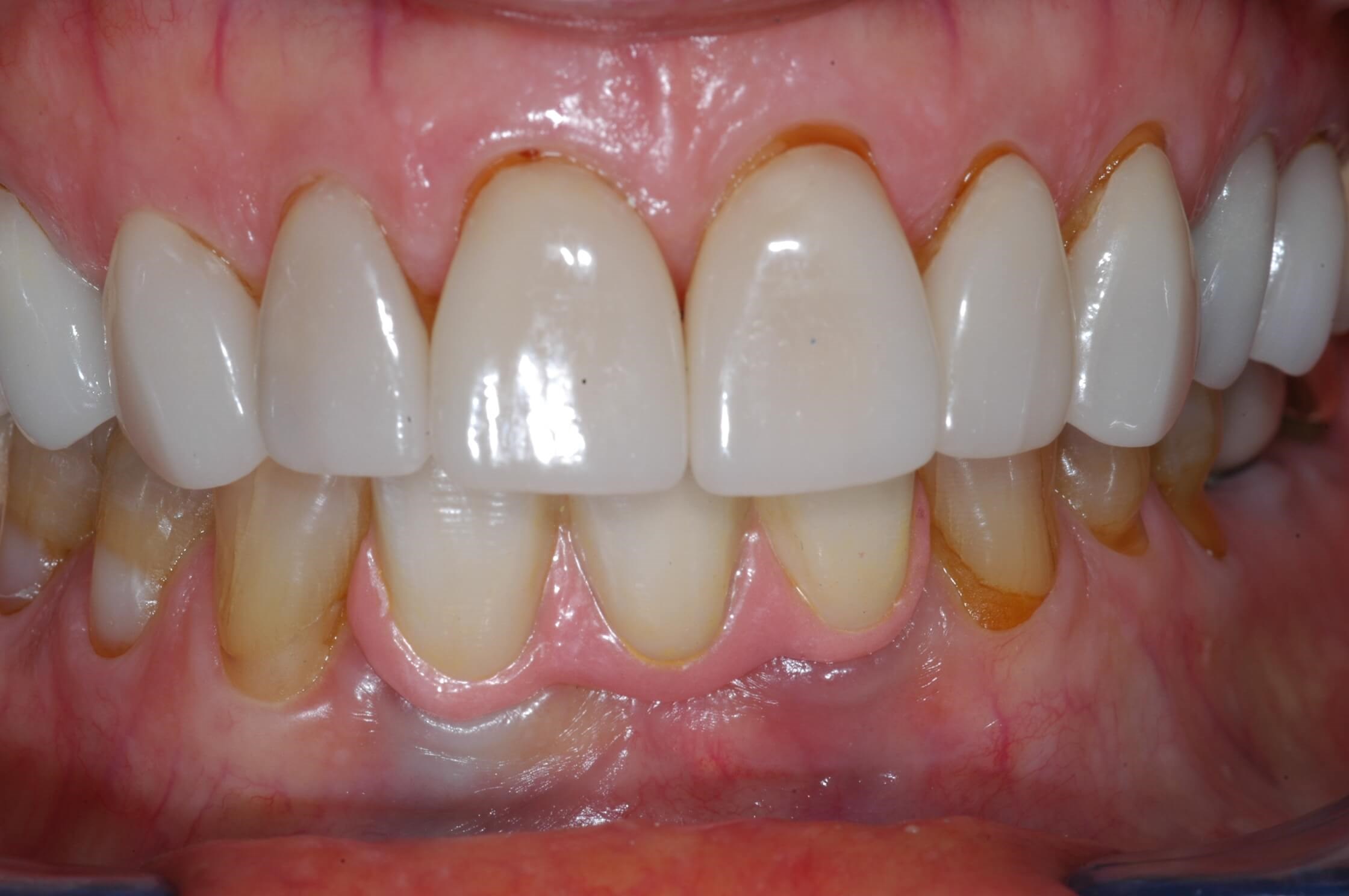 More pictures After