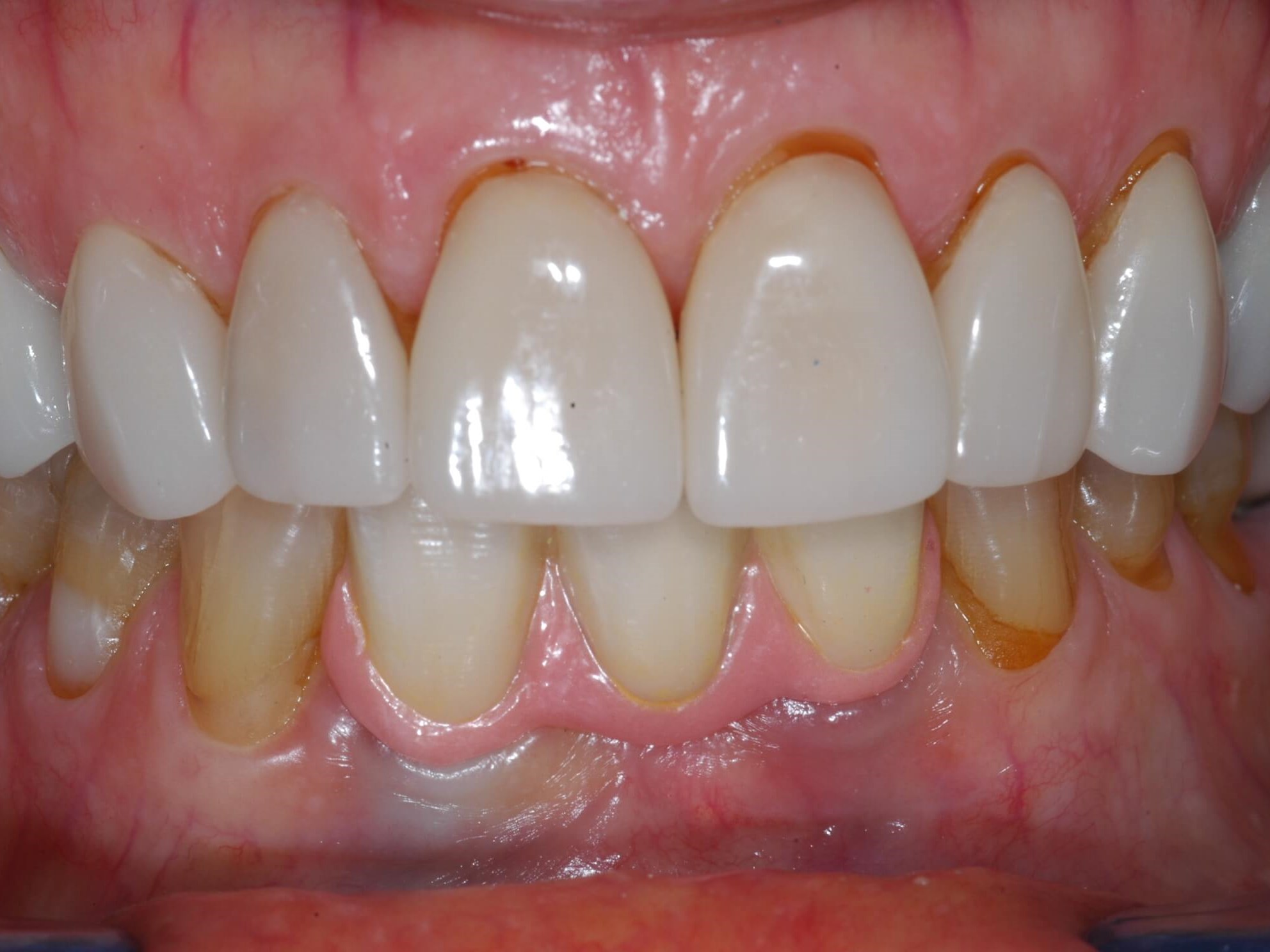 More pictures After