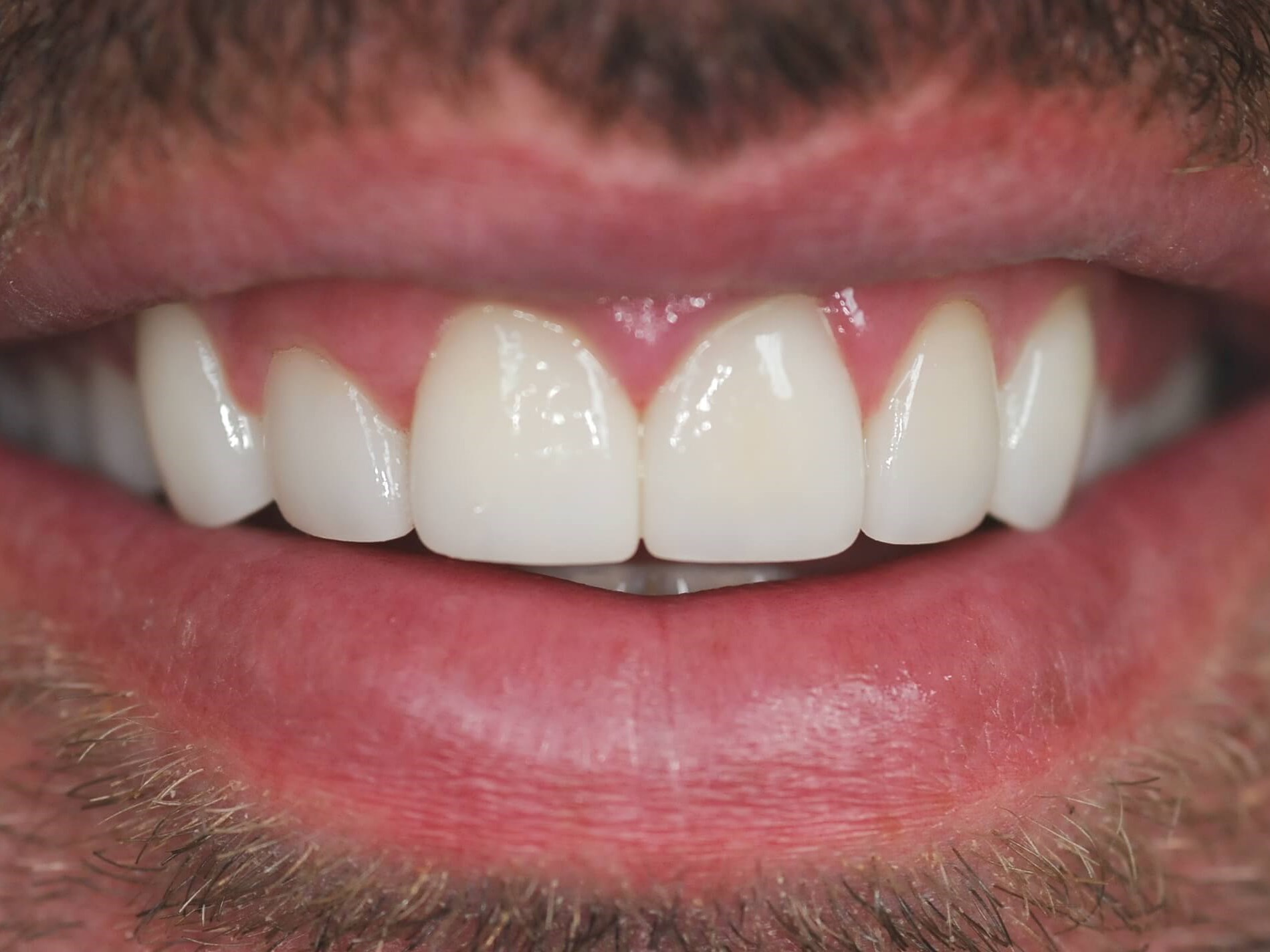 Final Comparison After