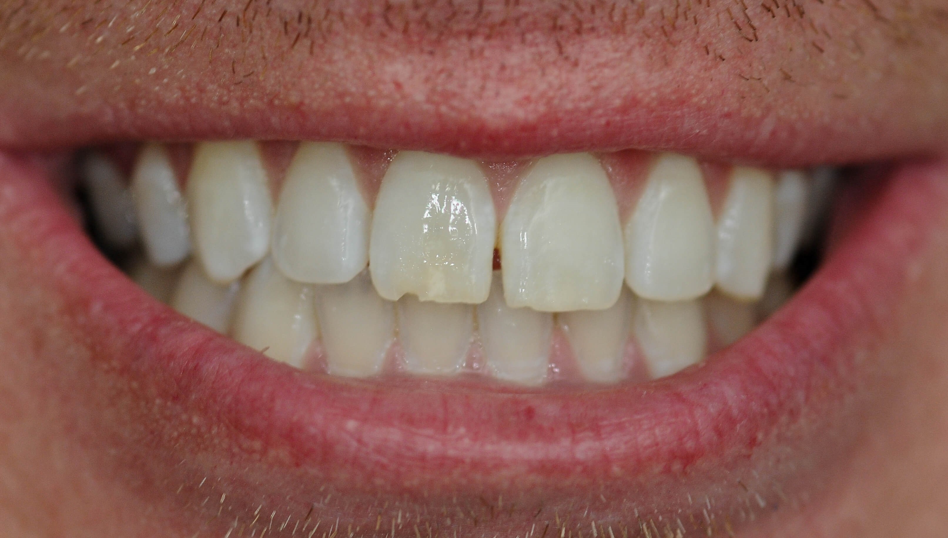 Before Image