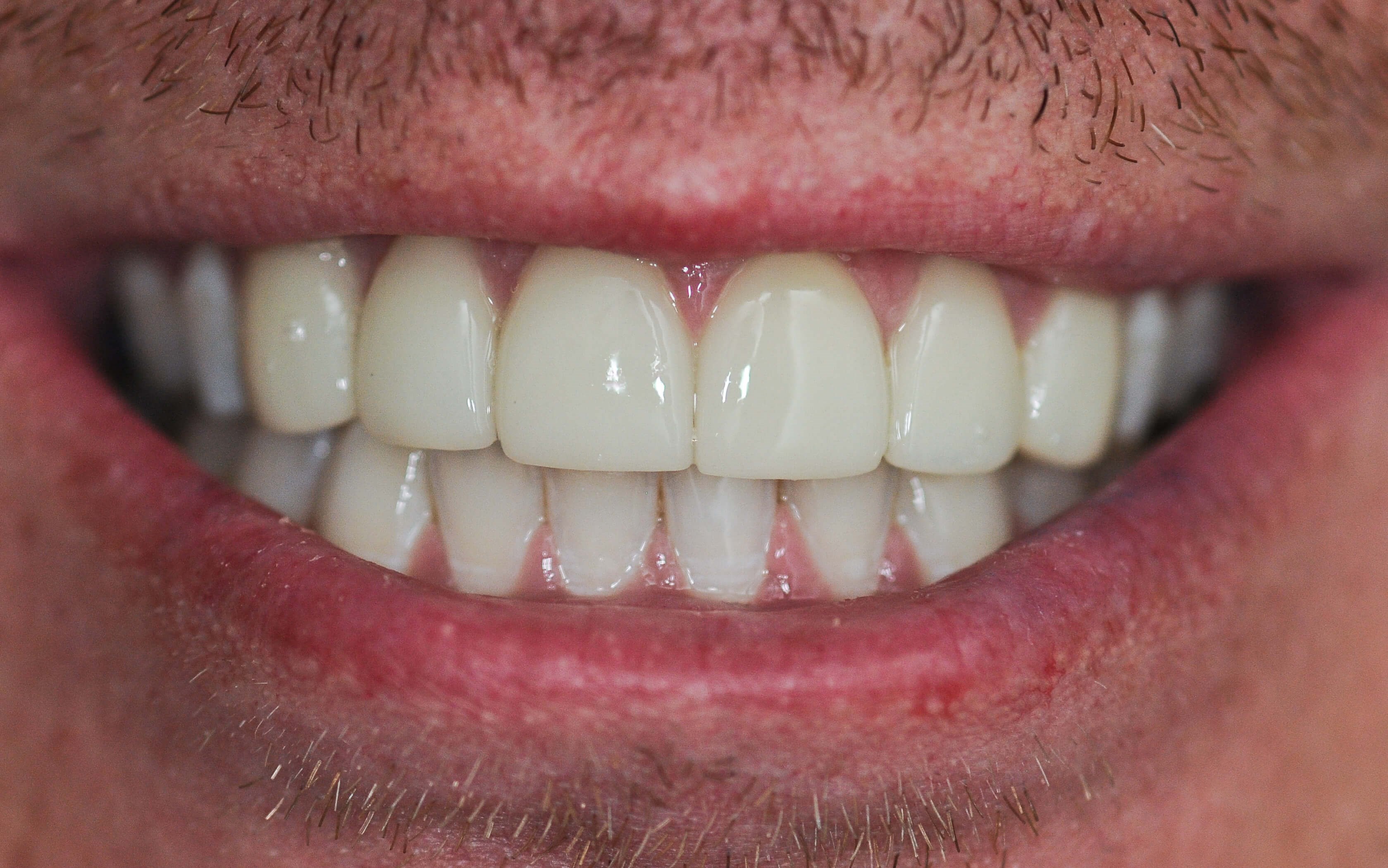 After Image