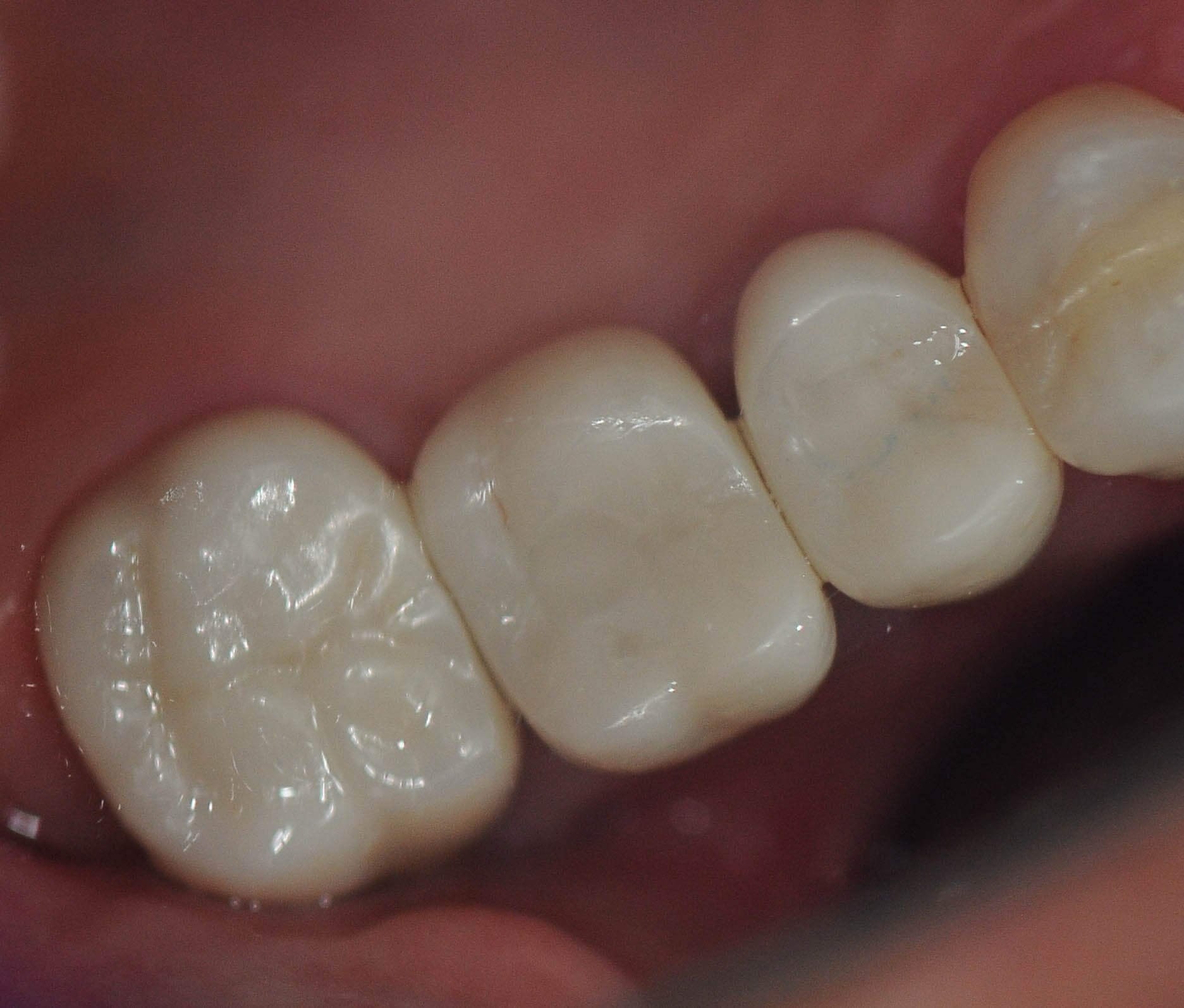 After Image