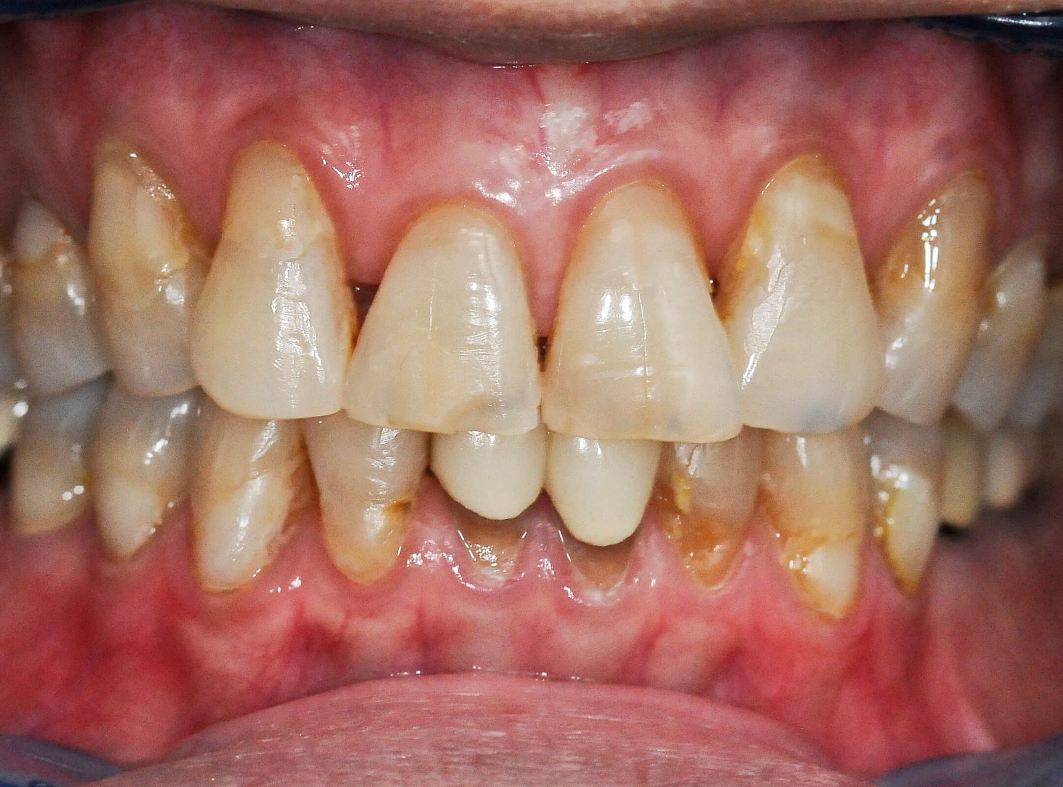 Before Image
