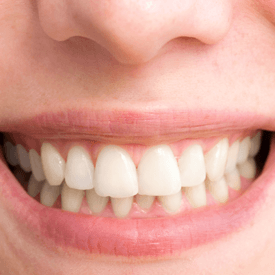 Periodontal Treatment